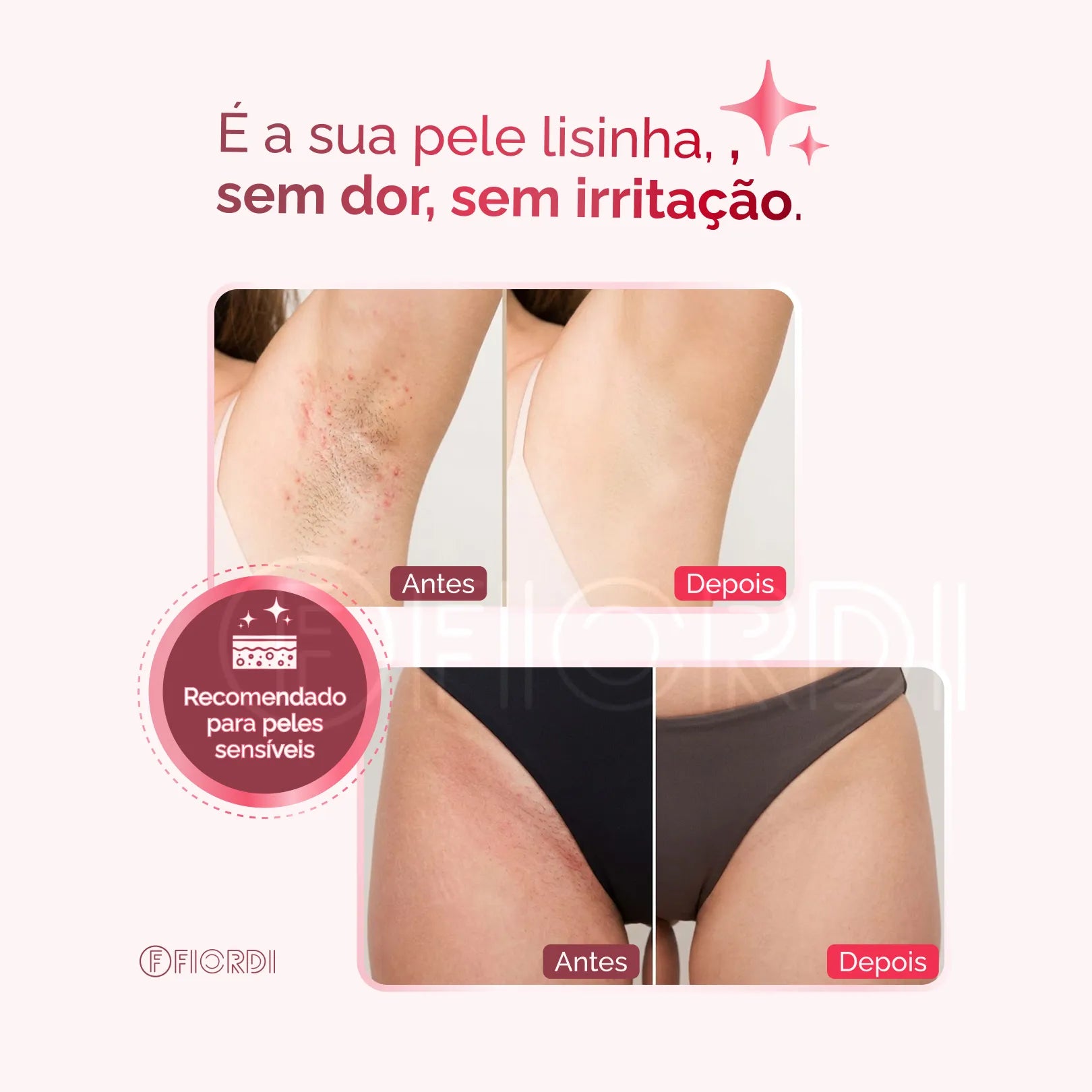 Depilador Elétrico 4 em 1 - DermaFlex™