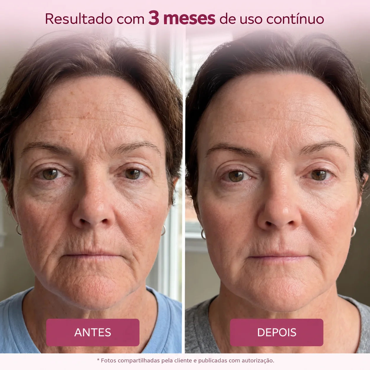 Glowora™ | Máscara Noturna de Bio-Colágeno