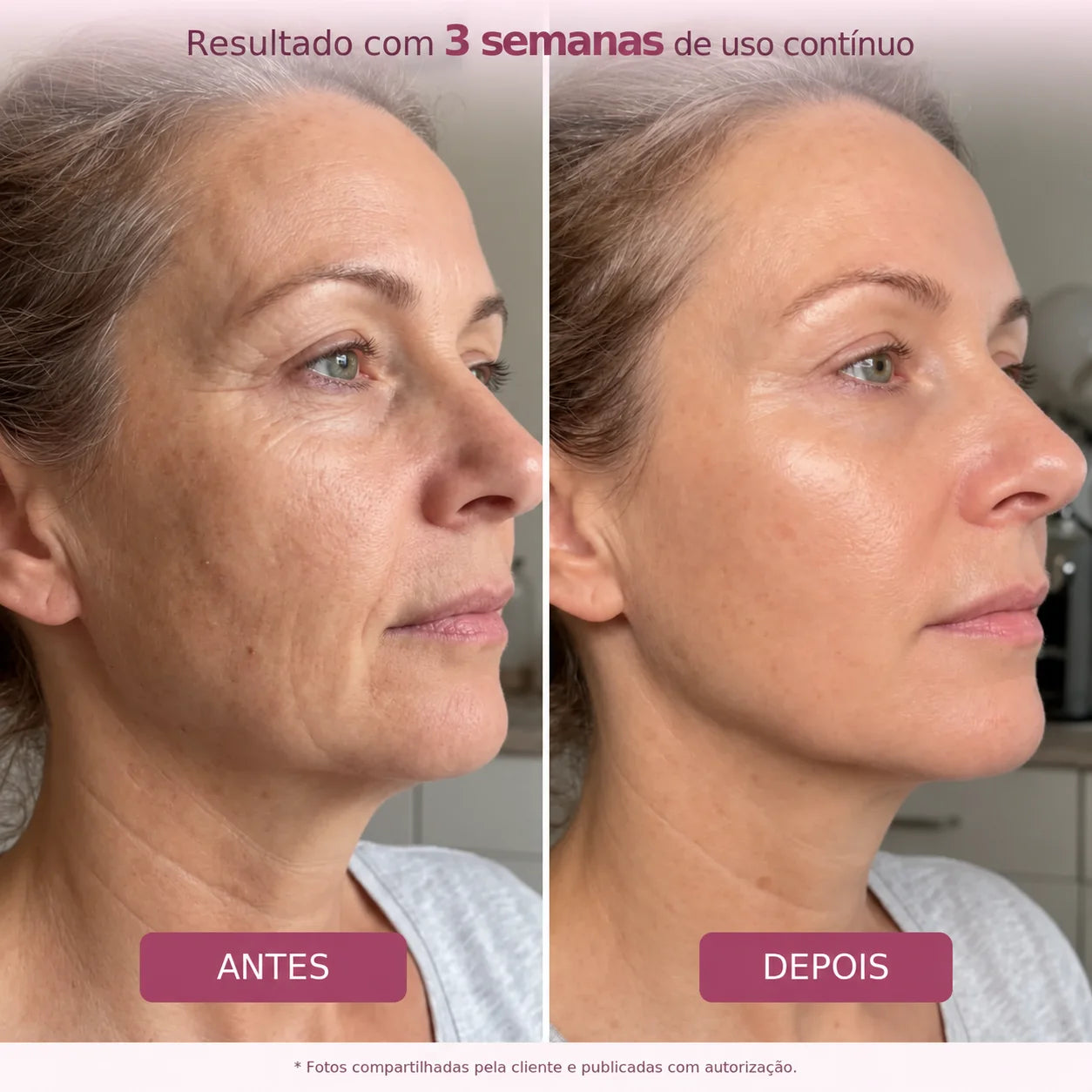 Glowora™ | Máscara Noturna de Bio-Colágeno