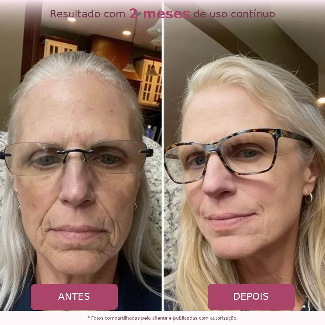 Glowora™ | Máscara Noturna de Bio-Colágeno
