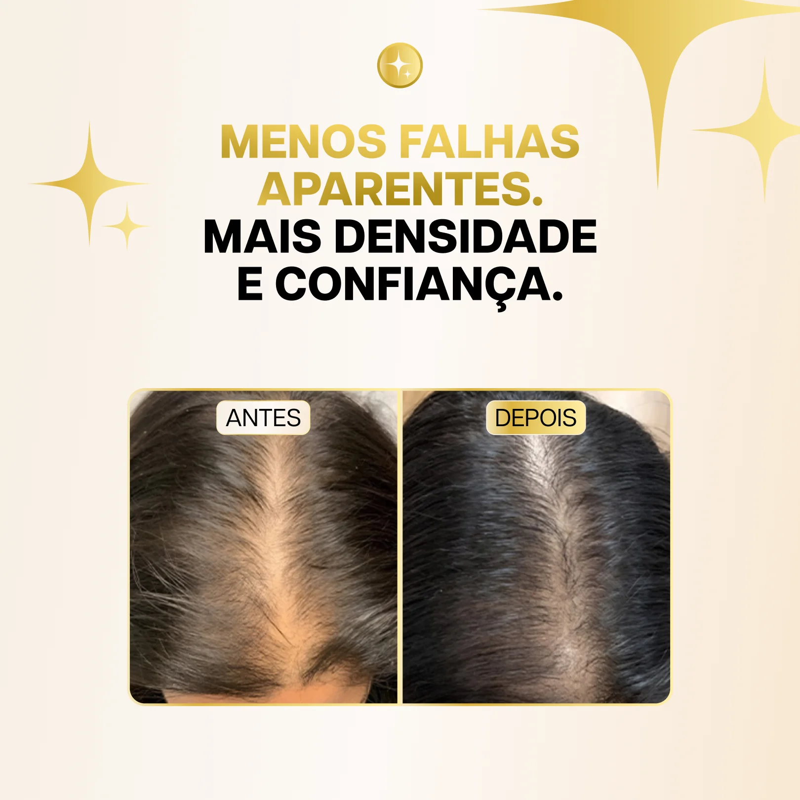 Escova de Terapia Capilar 4 em 1 - RevitaHair Pro™