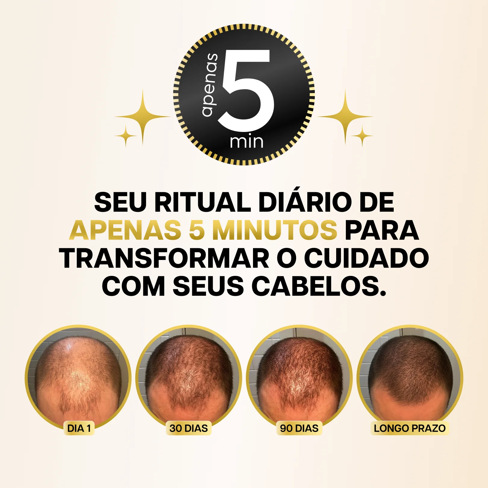 Escova de Terapia Capilar 4 em 1 - RevitaHair Pro™