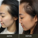 Escova de Terapia Capilar 4 em 1 - RevitaHair Pro™